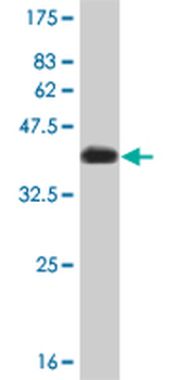 CHUK monoclonal antibody (M03), clone 4B8