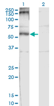 CHRND monoclonal antibody (M01), clone 2B2