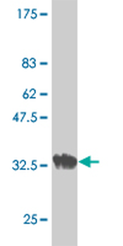 CHRND monoclonal antibody (M01), clone 2B2