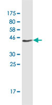 CHRNB2 monoclonal antibody (M01), clone 1C7