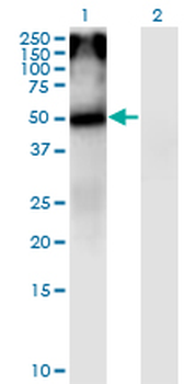 CHRNA5 monoclonal antibody (M01), clone 7D3
