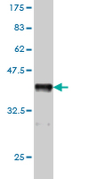 CHRNA5 monoclonal antibody (M01), clone 7D3