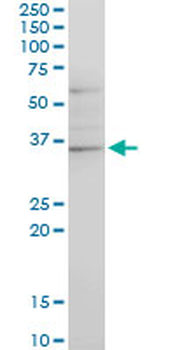 CHN1 monoclonal antibody (M03), clone 3A3