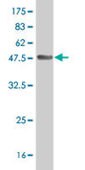 CHML polyclonal antibody (A01)