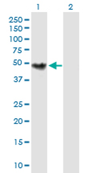 CHKB purified MaxPab mouse polyclonal antibody (B01P)