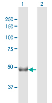 CHKA purified MaxPab rabbit polyclonal antibody (D01P)
