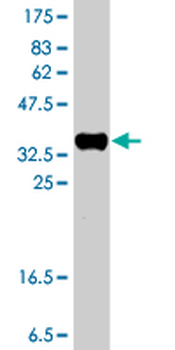 CHKA polyclonal antibody (A01)