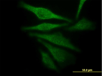 AKR1C4 monoclonal antibody (M01), clone 2C11