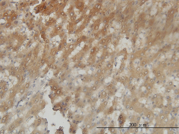 AKR1C4 monoclonal antibody (M01), clone 2C11