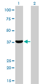 AKR1C4 monoclonal antibody (M01), clone 2C11