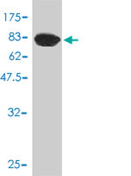 AKR1C4 monoclonal antibody (M01), clone 2C11