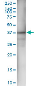 AKR1C4 MaxPab rabbit polyclonal antibody (D01)