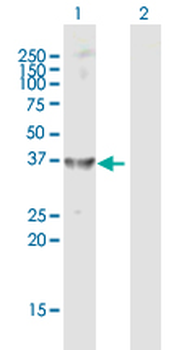 AKR1C4 MaxPab rabbit polyclonal antibody (D01)