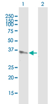 AKR1C4 MaxPab mouse polyclonal antibody (B01)