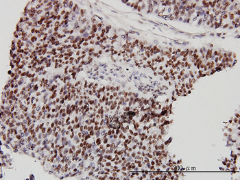 CHD4 monoclonal antibody (M01), clone 4H4