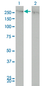 CHD4 monoclonal antibody (M01), clone 4H4