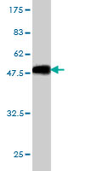 CHD4 monoclonal antibody (M01), clone 4H4