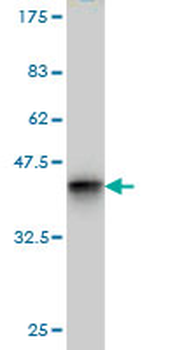 CHD3 monoclonal antibody (M01), clone 5E12