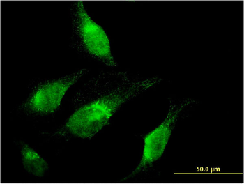 CHD1 monoclonal antibody (M04), clone 1G2