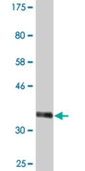 CHD1 monoclonal antibody (M04), clone 1G2