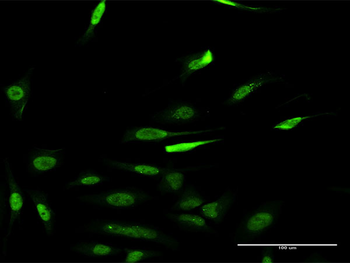 RCC1 monoclonal antibody (M02), clone 1C1