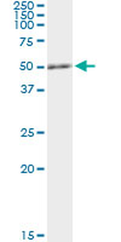 RCC1 monoclonal antibody (M02), clone 1C1
