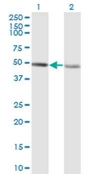 RCC1 monoclonal antibody (M02), clone 1C1