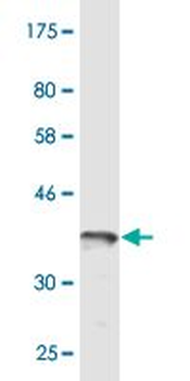 RCC1 monoclonal antibody (M02), clone 1C1