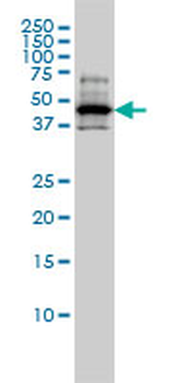 RCC1 monoclonal antibody (M01), clone 2F1