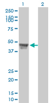 RCC1 monoclonal antibody (M01), clone 2F1