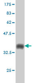 RCC1 monoclonal antibody (M01), clone 2F1
