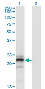 CGB monoclonal antibody (M05), clone 3B4
