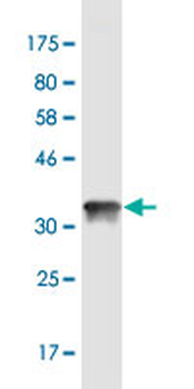 CGB monoclonal antibody (M05), clone 3B4