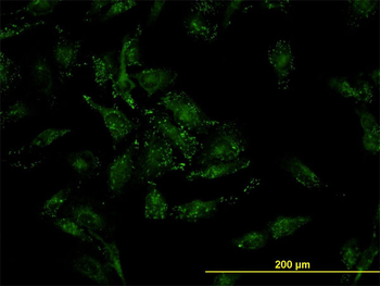 CFL2 monoclonal antibody (M03), clone 6G9