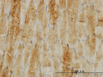 CFL2 monoclonal antibody (M03), clone 6G9