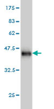 CFL2 monoclonal antibody (M03), clone 6G9