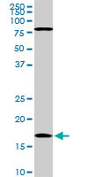CFL1 monoclonal antibody (M04), clone 1A1