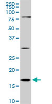 CFL1 monoclonal antibody (M04), clone 1A1