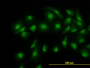 CFL1 monoclonal antibody (M04), clone 1A1