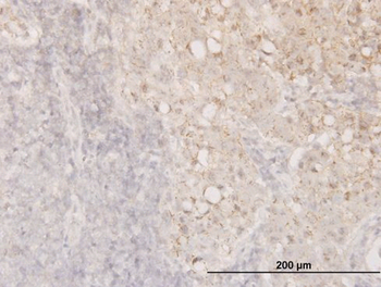 CFL1 monoclonal antibody (M04), clone 1A1