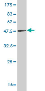 CFL1 monoclonal antibody (M04), clone 1A1