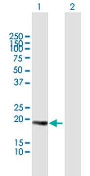 CETN3 purified MaxPab mouse polyclonal antibody (B01P)