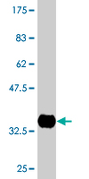 CETN1 monoclonal antibody (M05), clone 4C12