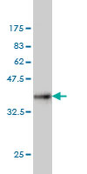 CETN1 monoclonal antibody (M01), clone 2A6