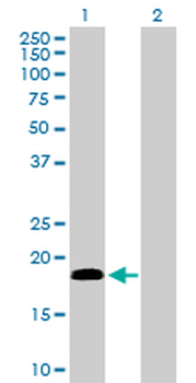 CETN1 purified MaxPab rabbit polyclonal antibody (D01P)