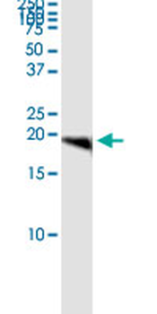 CETN1 MaxPab rabbit polyclonal antibody (D01)