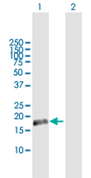 CETN1 MaxPab rabbit polyclonal antibody (D01)