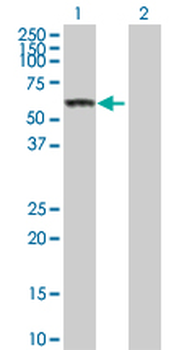 CES1 purified MaxPab rabbit polyclonal antibody (D01P)