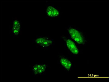 CDX1 monoclonal antibody (M07), clone 4C4