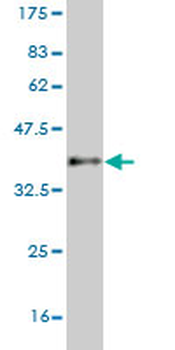CDX1 monoclonal antibody (M07), clone 4C4